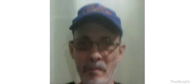My Face change