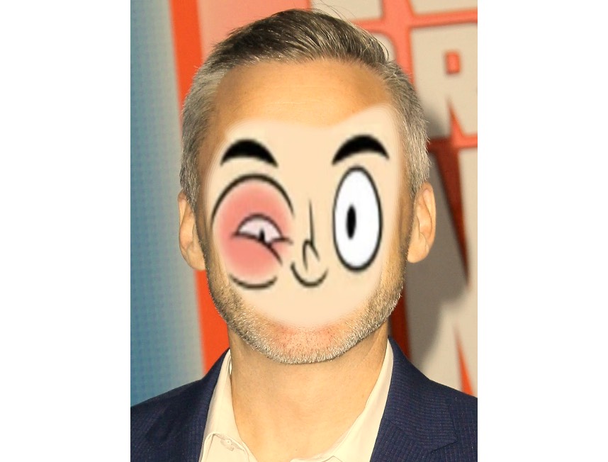 Pinkeye Craig Smith